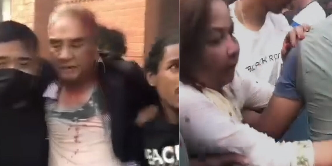 देउवाको टाउकामा १२ वटा टाँका